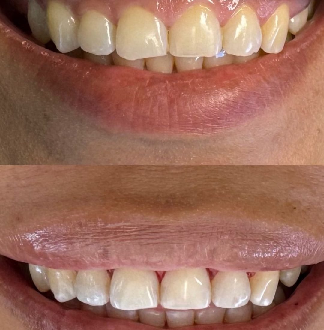 WhatsApp Image 2026-03-06 at 16.10.14